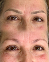 Micropigmentación. Efecto Nanoblanding - Foto 4