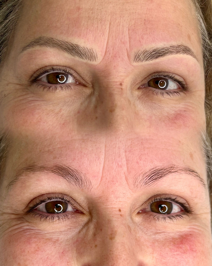 Micropigmentación. Efecto Nanoblanding